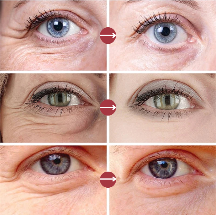 Batom Anti-Rugas para os Olhos